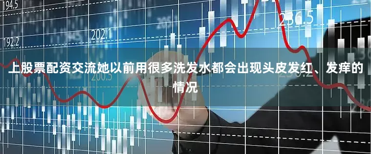 上股票配资交流她以前用很多洗发水都会出现头皮发红、发痒的情况